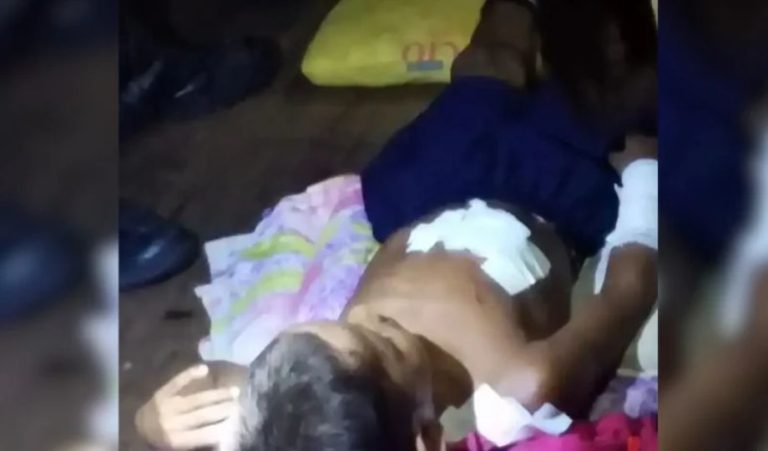 Criança é mordida por jacaré em Comunidade de Fonte Boa no Amazonas